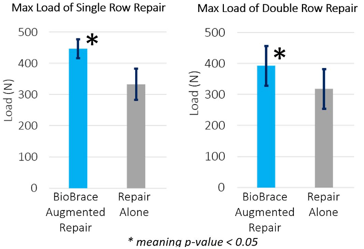 Figure 2: Comparison of max load (N) between BioBrace augmented rotator cuff repairs and repairs alone.