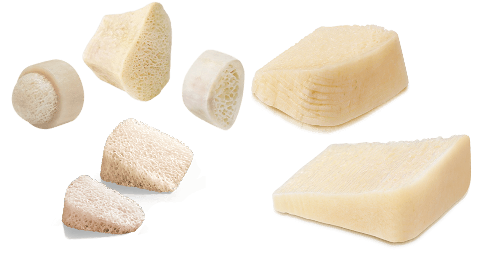 AlloAid® and ENHANCE® Wedges and Deformity Correction